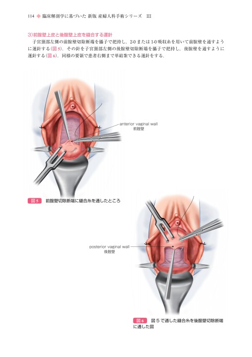 2168新版 産婦人科手術シリーズⅢ