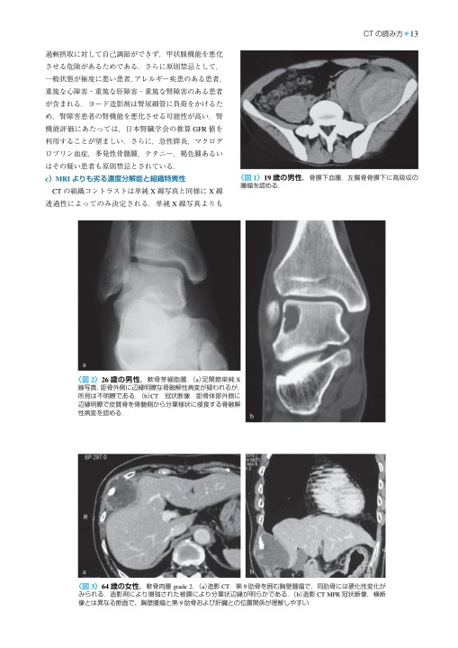 2172骨・軟部腫瘍-臨床・画像・病理 改訂第2版