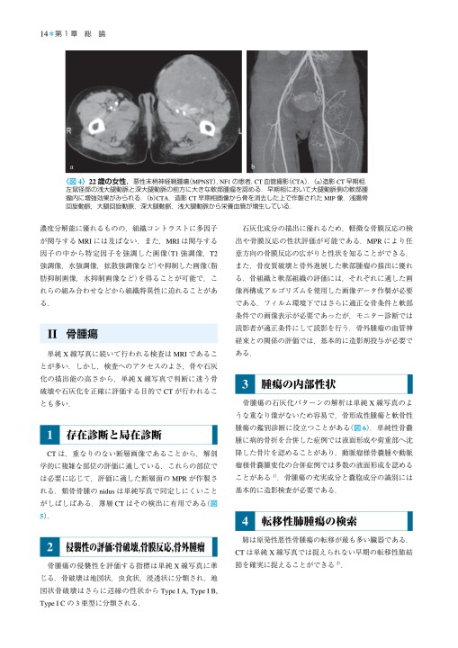 2172骨・軟部腫瘍-臨床・画像・病理 改訂第2版