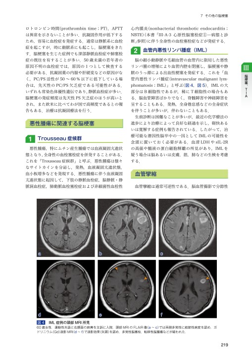 2236必携 脳卒中ハンドブック 改訂第3版