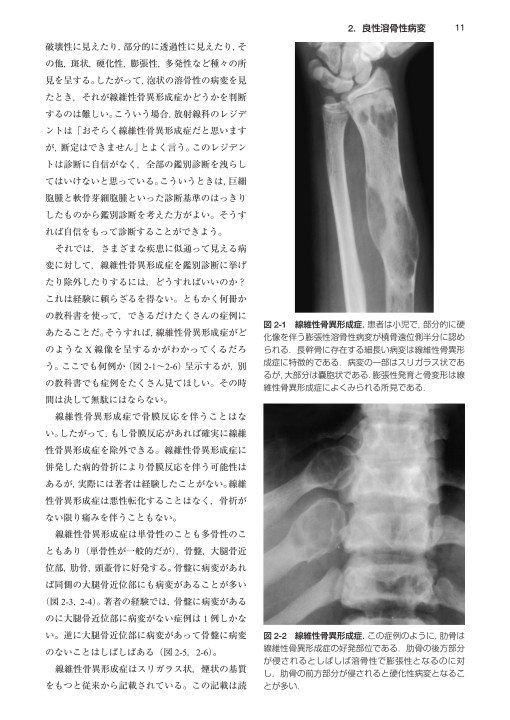 骨・関節の画像診断Ⅰ・Ⅱ2巻揃 grijasa.com