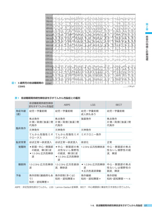 2309稀少てんかんの診療指標