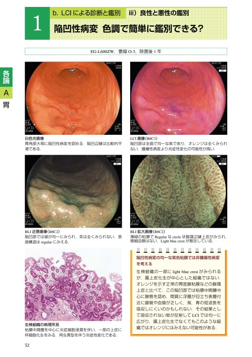 2429LCI内視鏡診断アトラス