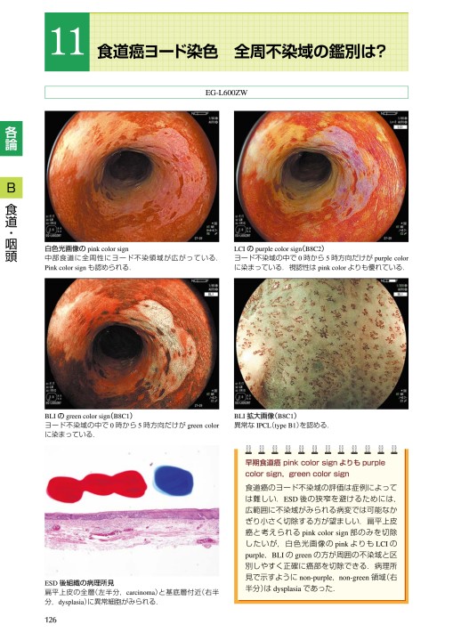 販売 手つなぎ型腺管