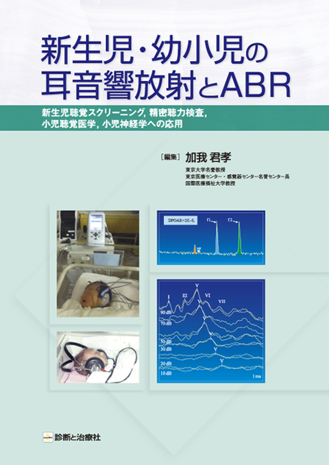 新生児・幼小児の耳音響放射とABR