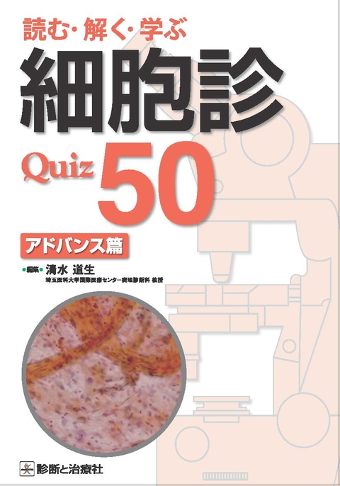 読む・解く・学ぶ　細胞診Quiz 50 アドバンス篇