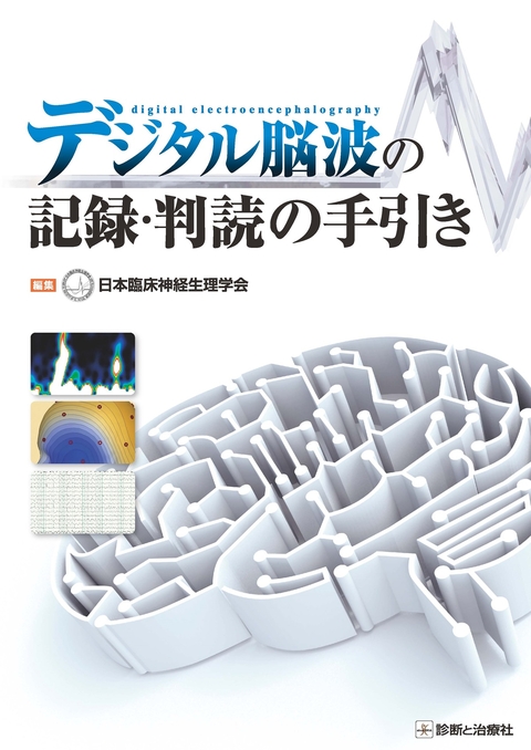 デジタル脳波の記録・判読の手引き