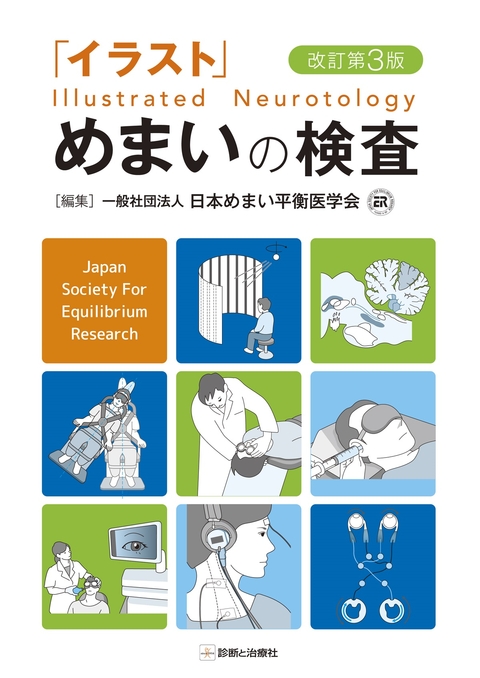 「イラスト」めまいの検査　改訂第３版