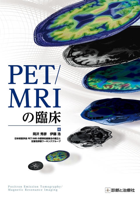 ＰＥＴ／ＭＲＩの臨床