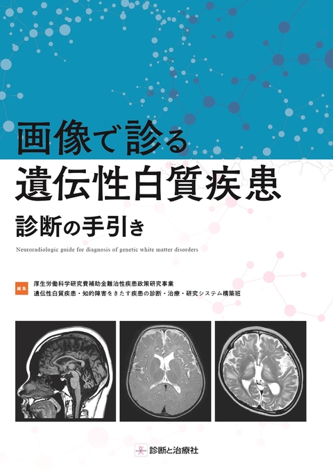 画像で診る遺伝性白質疾患 診断の手引き