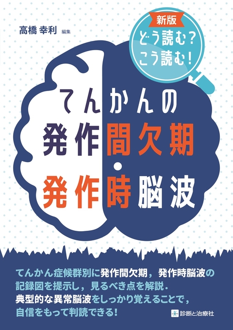 てんかんの発作間欠期・発作時脳波